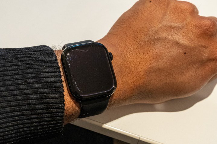 Damaged Apple Watch Series 10 on an arm that's wresting on a table