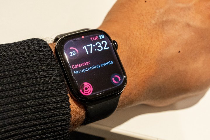 Damaged Apple Watch Series 10 on an arm that's wresting on a table with the display on