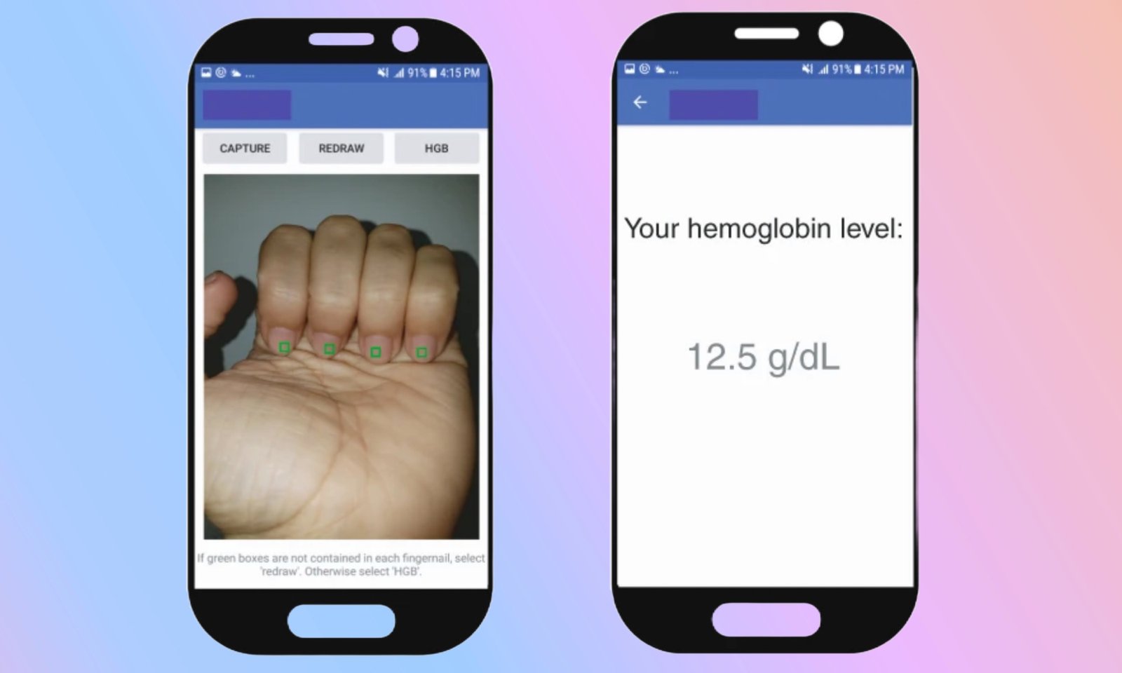 AI app assessing anemia risk on nail picture.